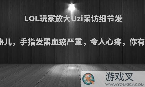 LOL玩家放大Uzi采访细节发现出大事儿，手指发黑血瘀严重，令人心疼，你有何看法?